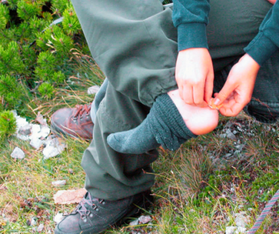 Foot Blisters