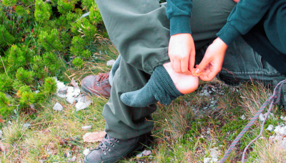 Foot Blisters Foot Blisters